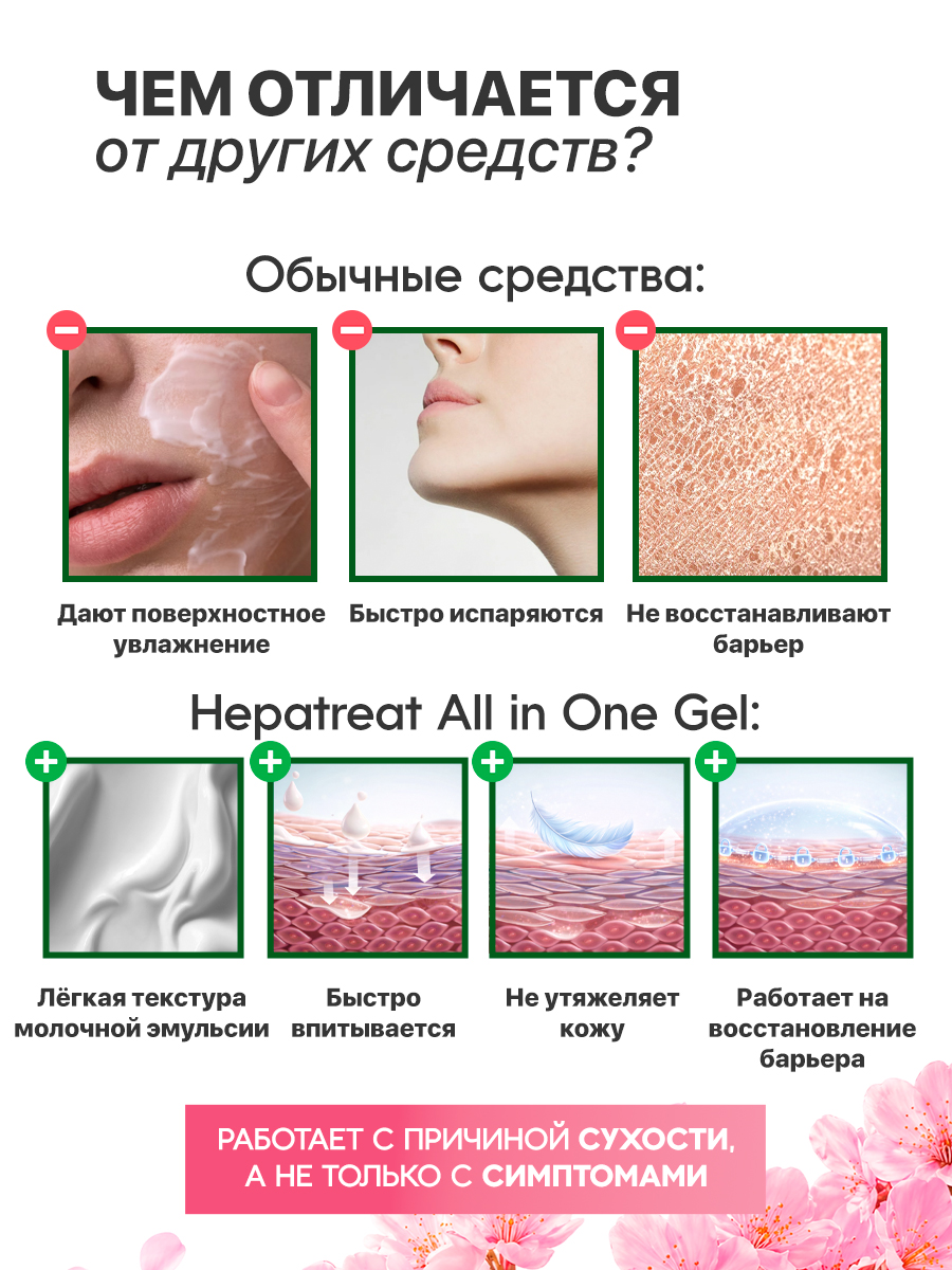 HEPATREAT Milky Lotion— крем для кожи,  ТМ ZETTOС. Эмульсия для лица и тела  230 г