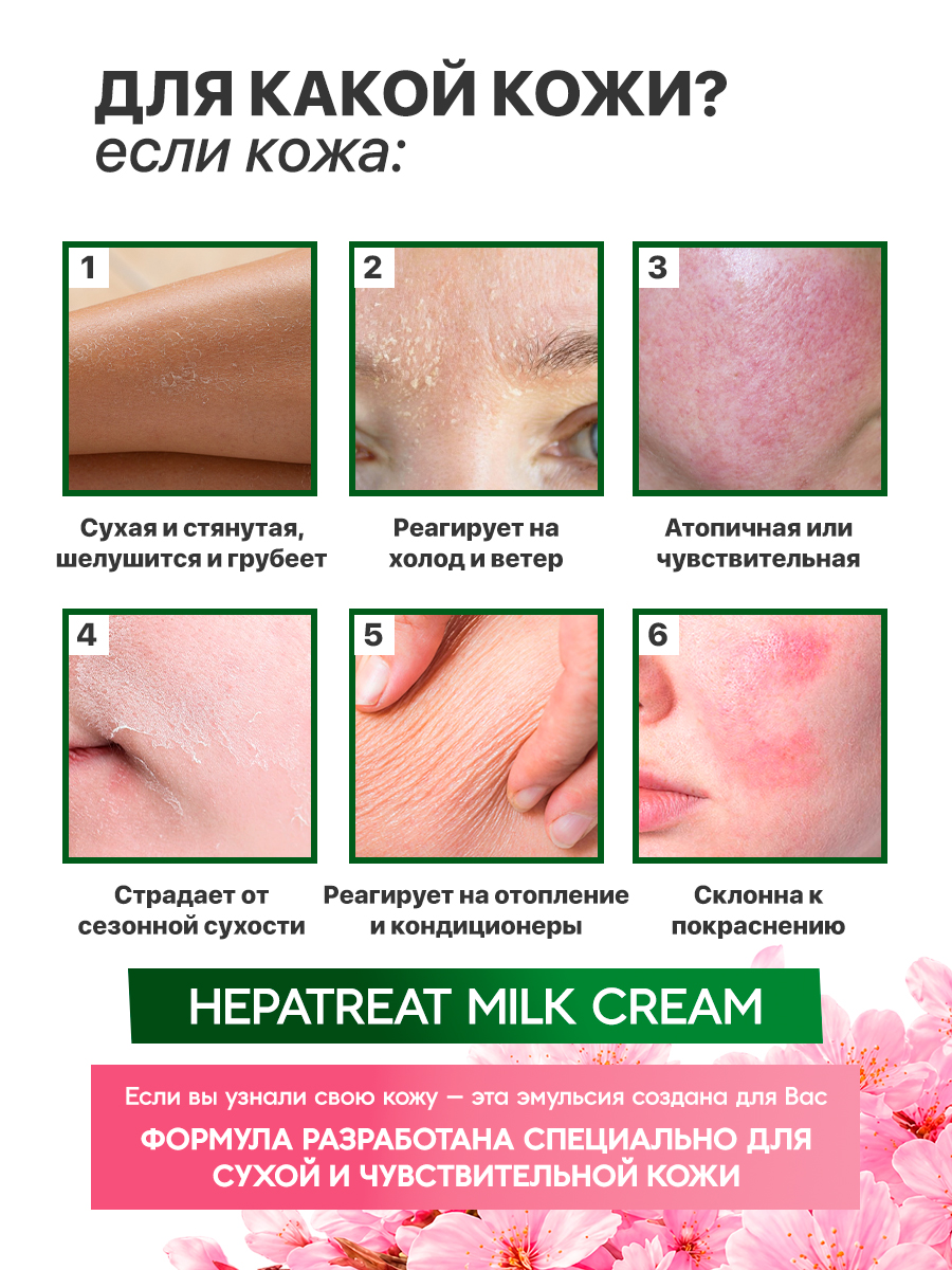 HEPATREAT Milky Lotion— крем для кожи,  ТМ ZETTOС. Эмульсия для лица и тела  230 г