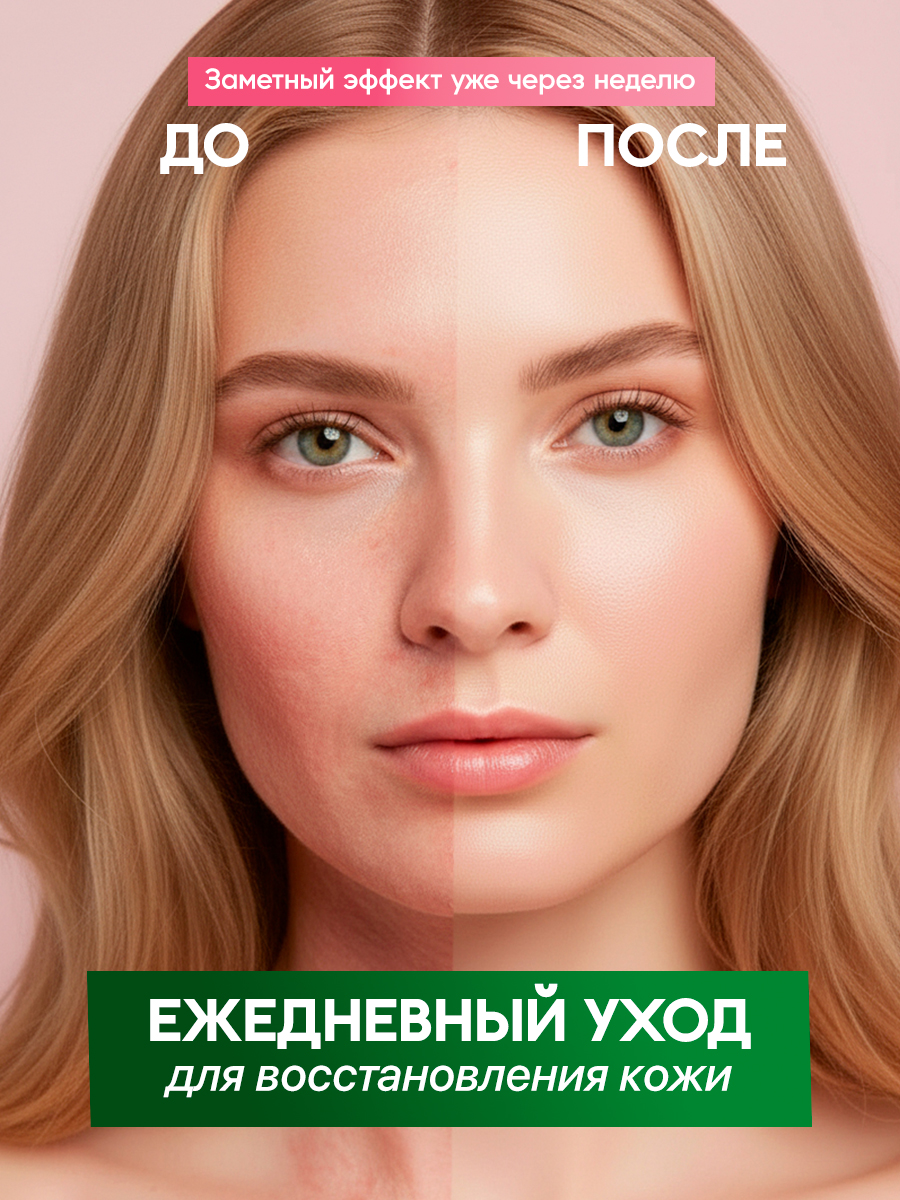 Hepatreat Skin Lotion — косметический лосьон для кожи, ТМ ZETTOC.  Для лица и тела для чувствительной кожи, 380 мл