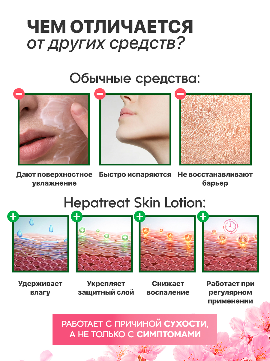 Hepatreat Skin Lotion — косметический лосьон для кожи, ТМ ZETTOC.  Для лица и тела для чувствительной кожи, 380 мл