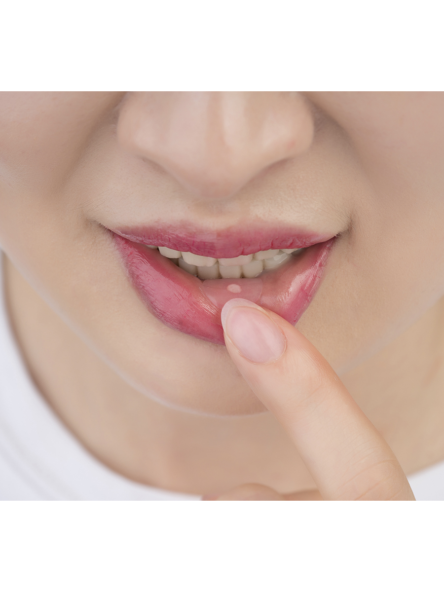 НАБОР: Заживляющий пластырь для слизистой рта CURATICK, 2шт/ упак. - 4шт/2упак.