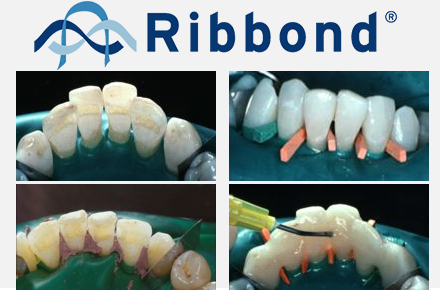 Клинический случай. Говард Strassler, DMD