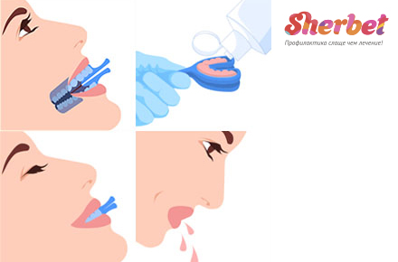 Инструкция по применению гелей и ложек Sherbet