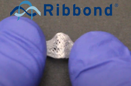 Видео: Сравнение волокон Ribbond с другими материалами для шинирования